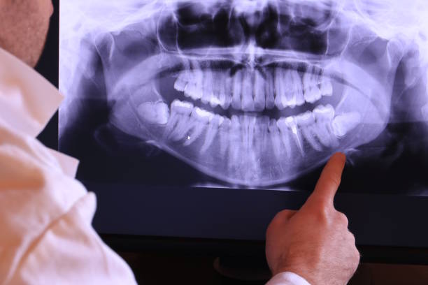 Best Emergency Dental Extractions in Troy, TN
