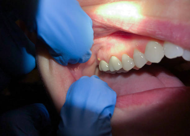 Best Emergency Dental Services for Seniors in Troy, TN