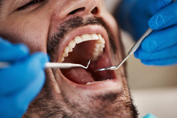 Best Emergency Root Canal Treatment in Troy, TN